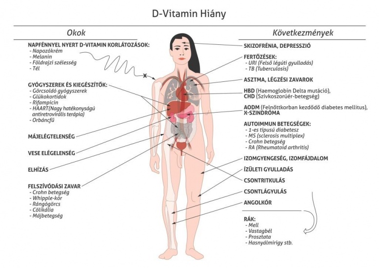 Krónikus gyulladás: A D-vitamin-kiegészítők segíthetnek a csökkentésben?